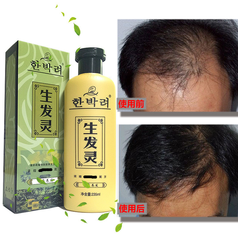 生发液增发防脱发育发密发护乌快速精丁额头养固治剂产品正品头发